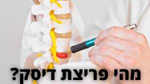 Read more about the article אלעד לאור עונה: מהי פריצת דיסק והאם ניתן לטפל בה?