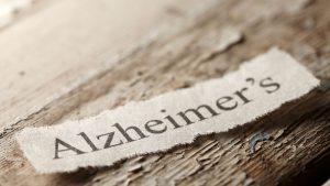 עתיד הטיפול באלצהיימר: טיפולים ומחקרים חדשים